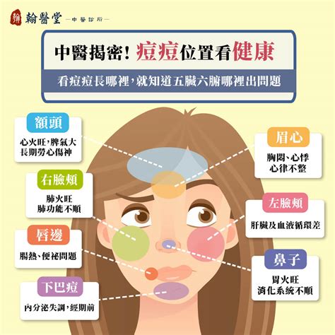 痘痘位子|9種「痘痘位置」透露你的身體狀況！額頭冒痘可能是。